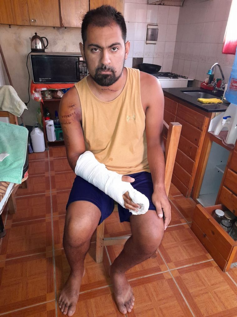 FOTO: El taxista atacado en asalto en Carlos Paz