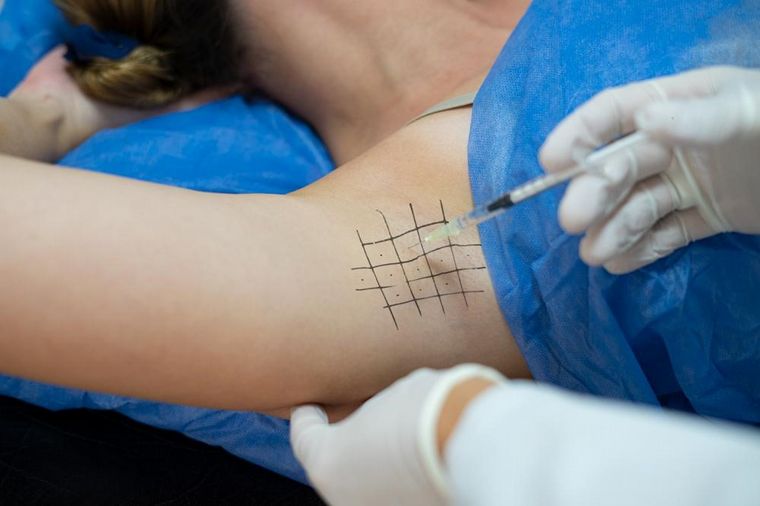 Hiperhidrosis, una enfermedad con distintos tratamientos posibles.