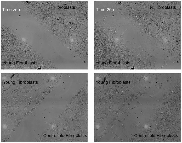 Las imágenes del rejuvenecimiento celular.