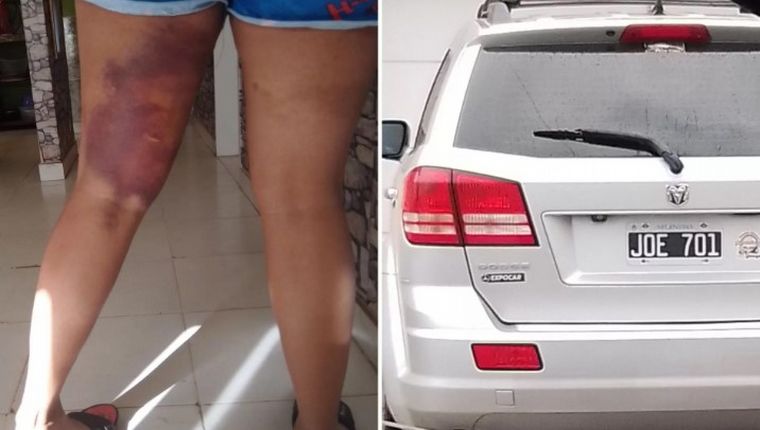 Discutieron por un choque y una atropelló a la otra