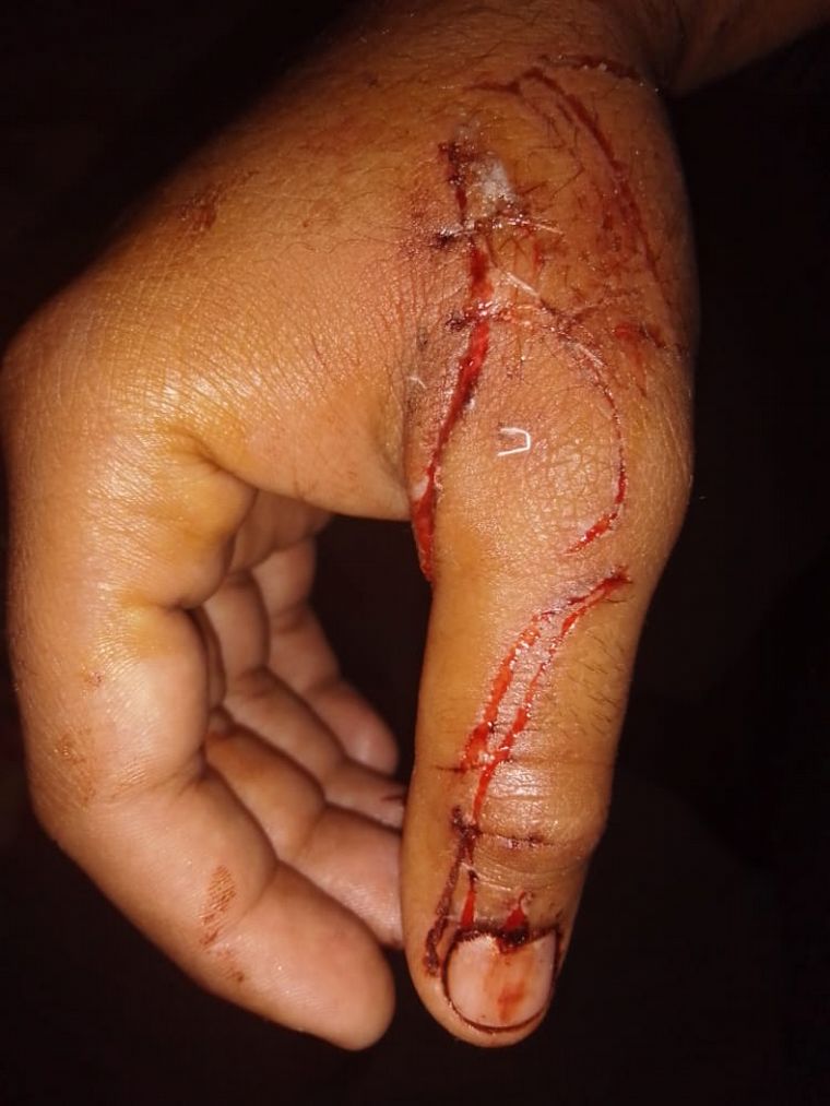 Un hombre denunció que fue atacado por cuarta vez por el perro pitbull de un vecino.