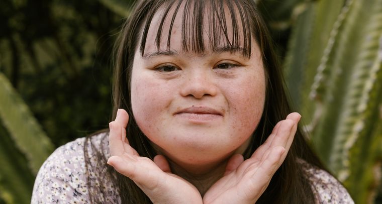 FOTO: La importancia de cuidar la piel cuando hay síndrome de Down