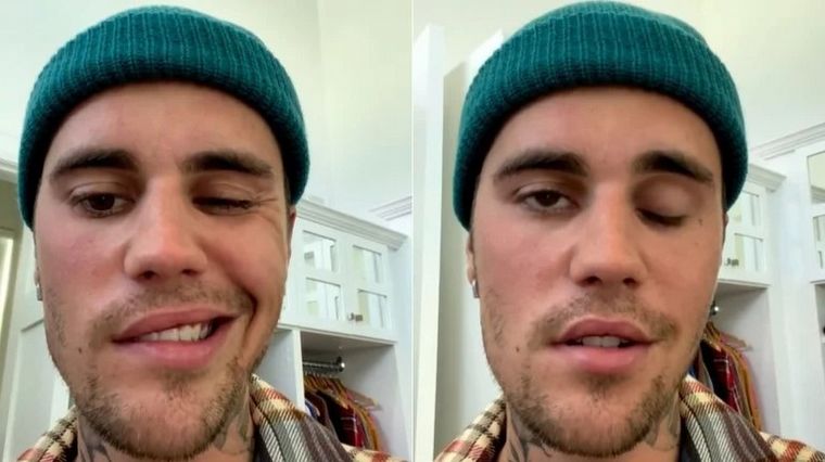 Justin Bieber anunció la cancelación de sus shows por una parálisis facial.