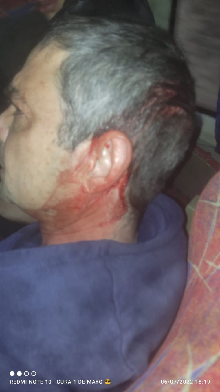 Hinchas de Talleres denuncian represión y maltrato de la Policía de Santa Fe.