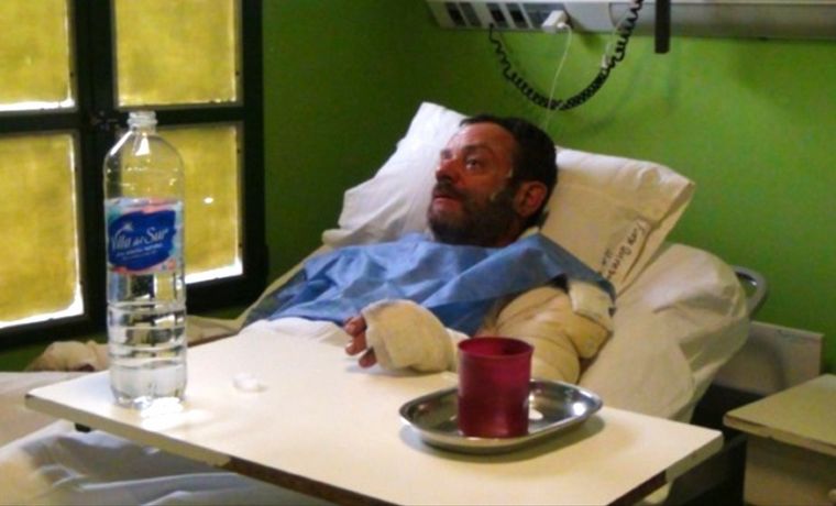 El hombre que resultó con quemaduras (Foto: diario Jornada)