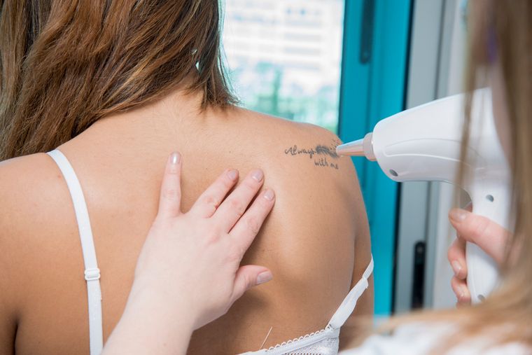 Alejandro Cuevas: “Se pueden sacar todos los tatuajes”.