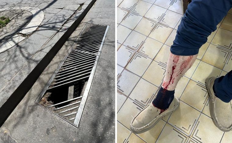 FOTO: Caminaba por la plaza San Martín, pisó un desagüe roto y terminó lesionado