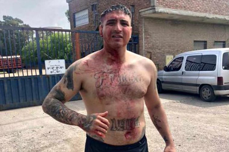 FOTO: Una brutal pelea tuvo lugar entre distintas facciones de la UOCRA en Ensenada.