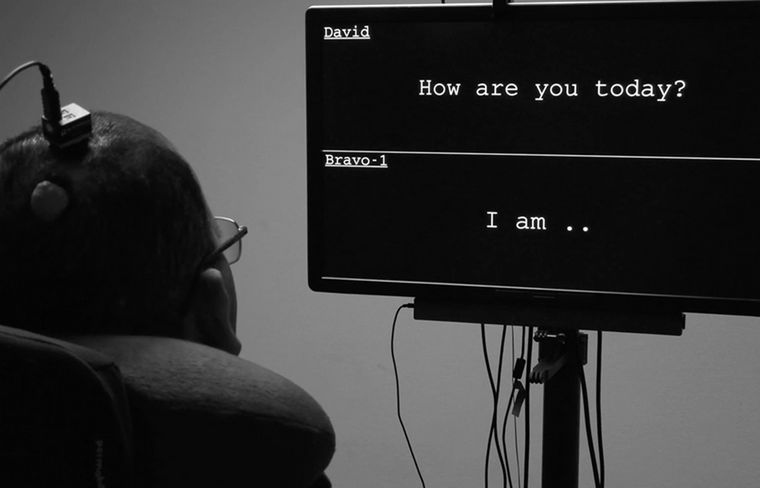 La investigación se realizó en la Universidad de California en San Francisco (UCSF)