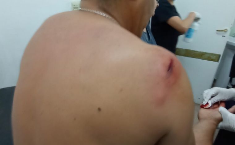 FOTO: El comisario mayor Gustavo Vergara resultó herido. (Foto gentileza: Policía)