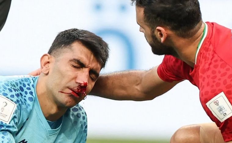 FOTO: Irán perdió por lesión a su arquero Alireza Beiranvand.