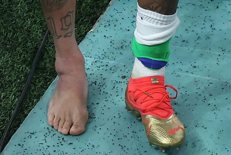 FOTO: Neymar preocupó a todo Brasil después de la victoria ante Serbia