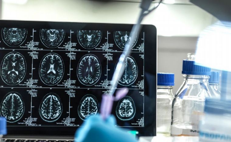 El primer fármaco contra el Alzheimer es