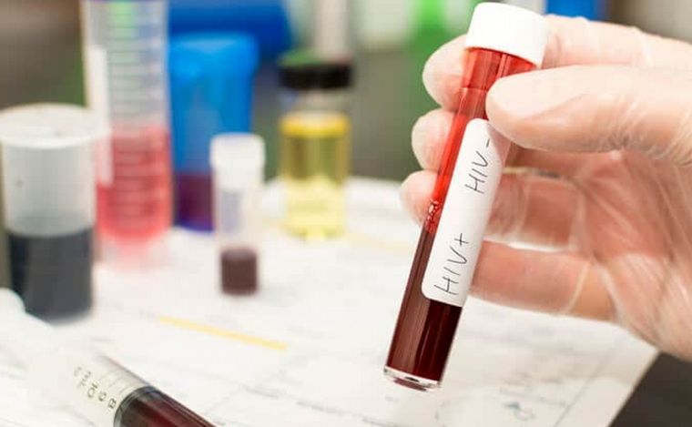 Más de 140.000 personas viven con VIH en Argentina y 13% no lo sabe