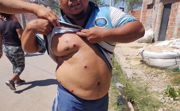 FOTO: El padre de Máximo Geres recibió una gran candidad de balas de gomas. 