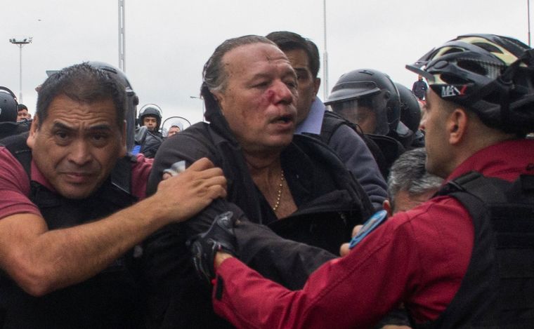 Berni, tras ser golpeado y asistido: 