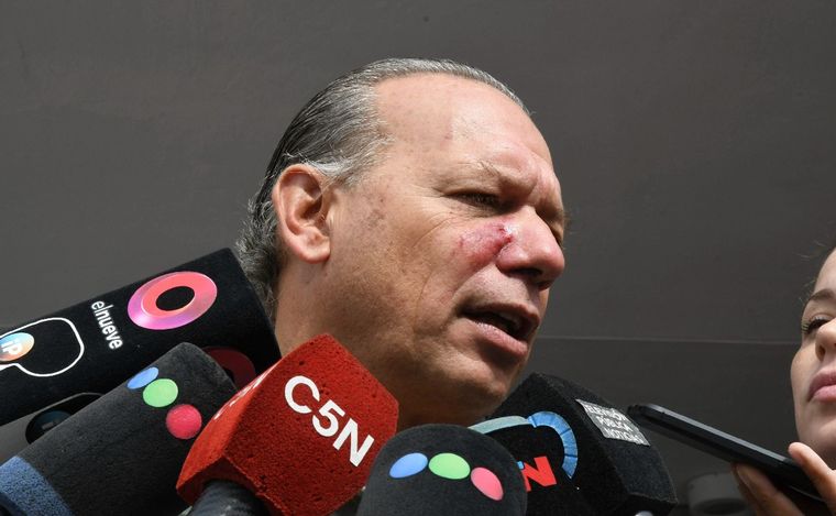 Berni tras ser golpeado este lunes por choferes.