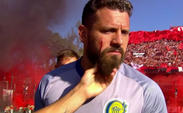 Clásico Rosarino: Broun fue agredido ni bien piso la cancha del Coloso del Parque. 