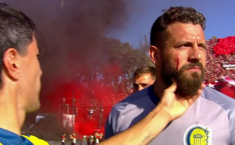 Broun, el gran protagonista del Clásico, agredido no permitió que se suspendiera.