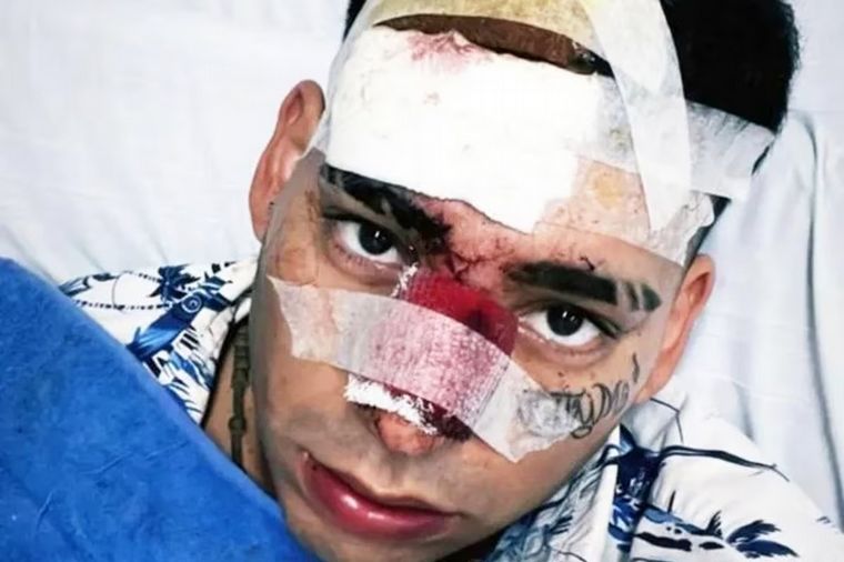 FOTO: El cantante mostró su cara en redes tras el accidente automovilístico.