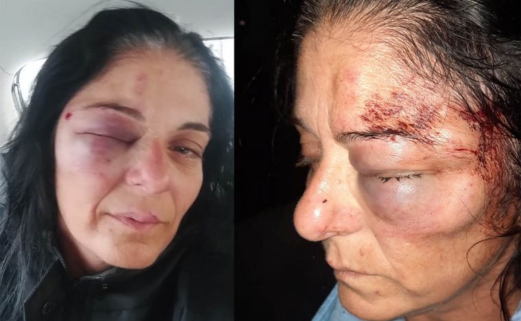 Brutal agresión a colectivera en intento de robo: asamblea y pedido de seguridad.